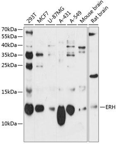 Anti-ERH Antibody (CAB12381)