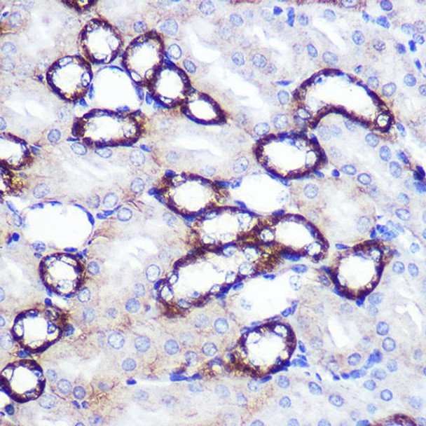 Anti-SIRT2 Antibody (CAB12575)