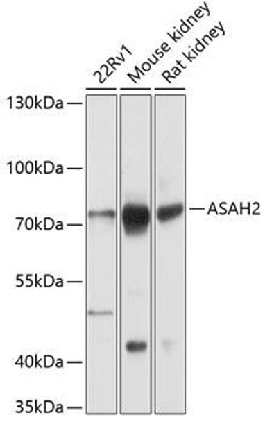 Anti-ASAH2 Antibody (CAB12596)