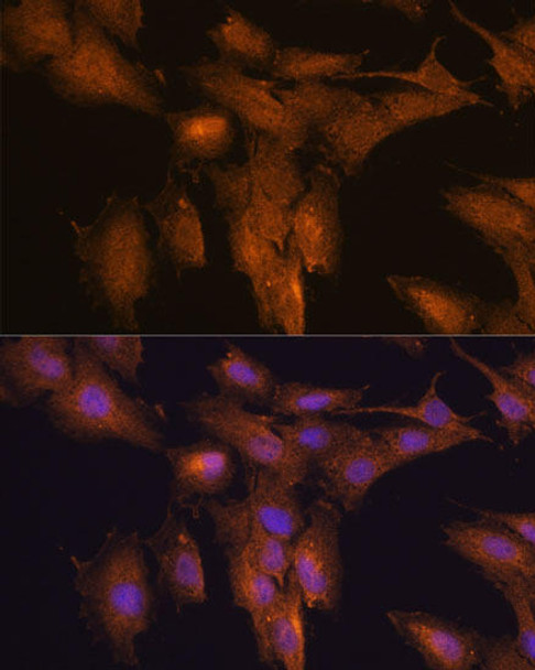 Anti-TSLP Antibody (CAB13134)