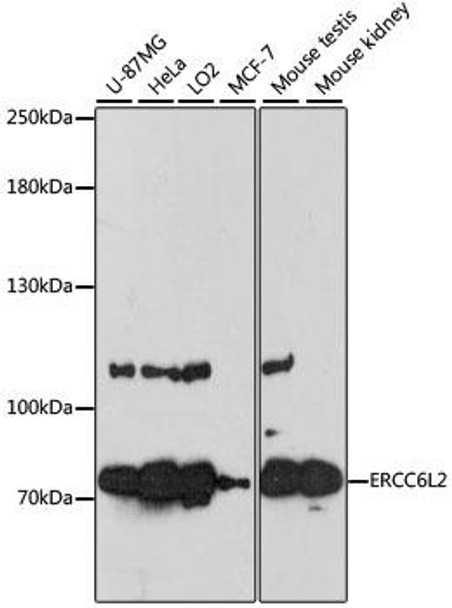 Anti-ERCC6L2 Antibody (CAB13144)
