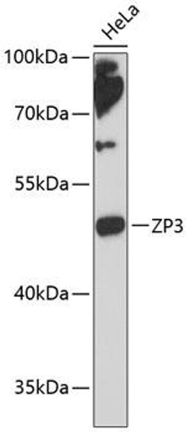 Anti-ZP3 Antibody (CAB13156)