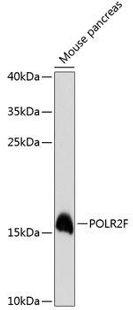 Anti-POLR2F Antibody (CAB13171)