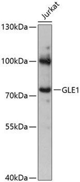 Anti-GLE1 Antibody (CAB13207)