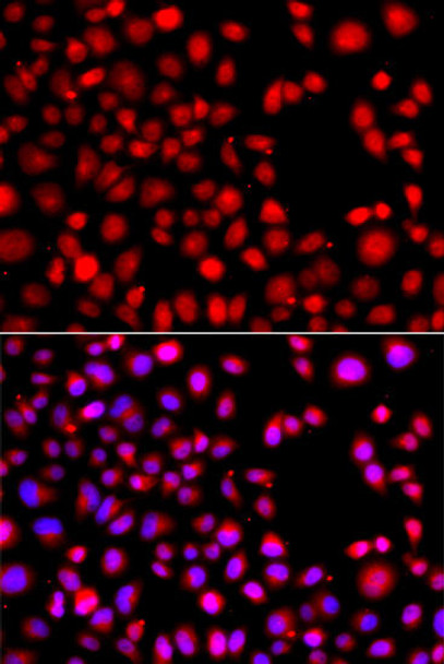 Anti-HLX Antibody (CAB13313)