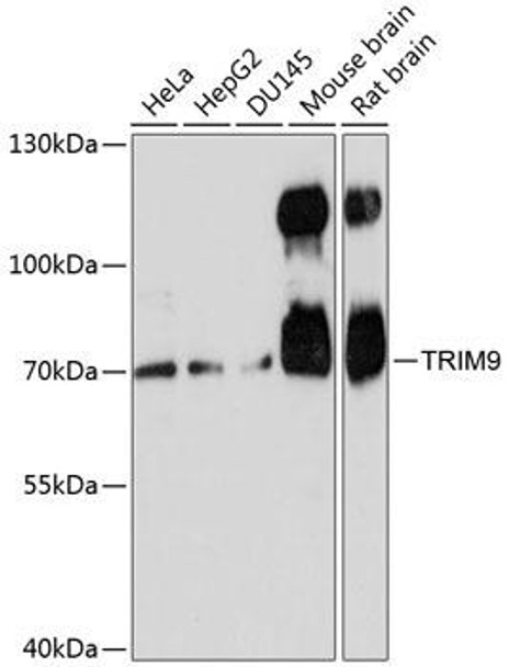 Anti-TRIM9 Antibody (CAB13896)