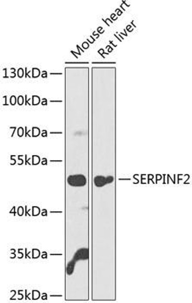 Anti-SERPINF2 Antibody (CAB14043)