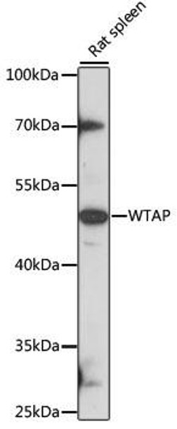 Anti-WTAP Antibody (CAB14695)