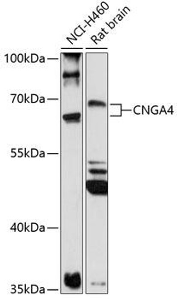 Anti-CNGA4 Antibody (CAB14720)