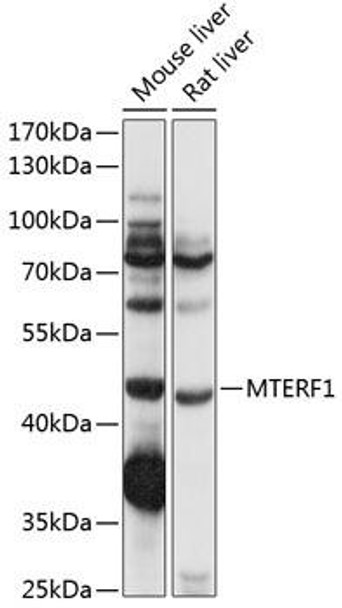 Anti-MTERF Antibody (CAB14805)