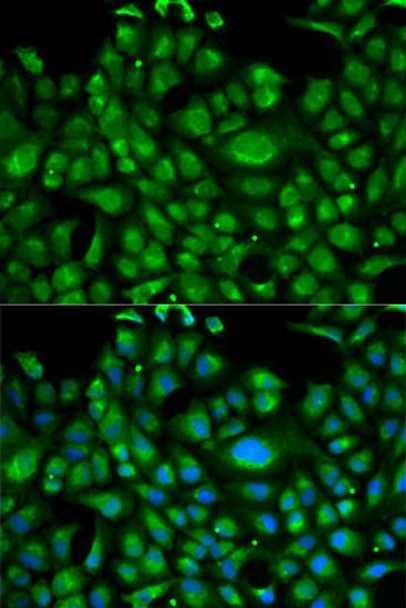 Anti-HSPA1L Antibody (CAB1856)