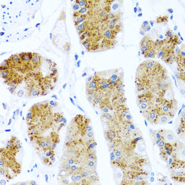 Anti-C8orf4 Antibody (CAB6241)