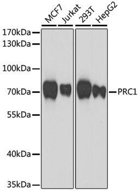 Anti-PRC1 Antibody (CAB7029)