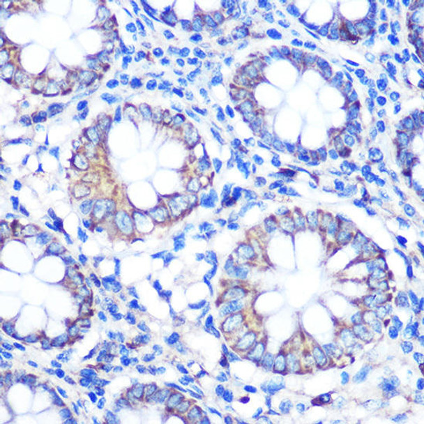 Anti-TFEB Antibody (CAB7311)