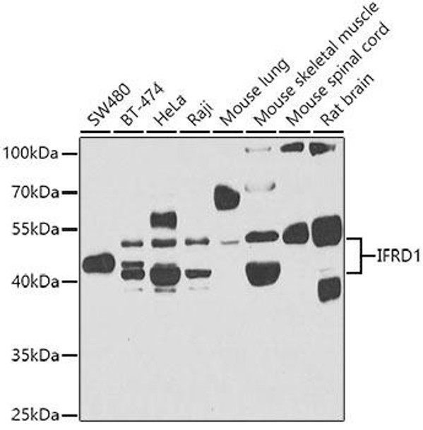 Anti-IFRD1 Antibody (CAB7439)