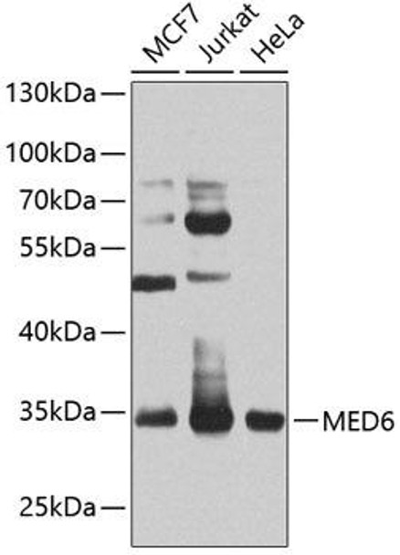 Anti-MED6 Antibody (CAB8181)