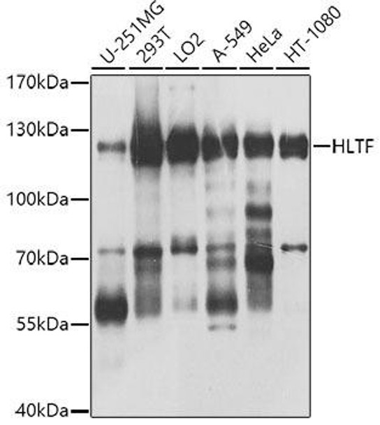 Anti-HLTF Antibody (CAB8353)