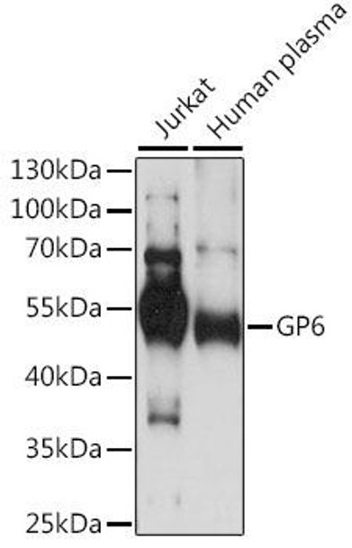 Anti-GP6 Antibody (CAB14999)