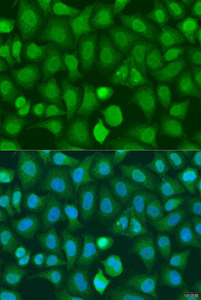 Anti-CHD1 Antibody (CAB15038)