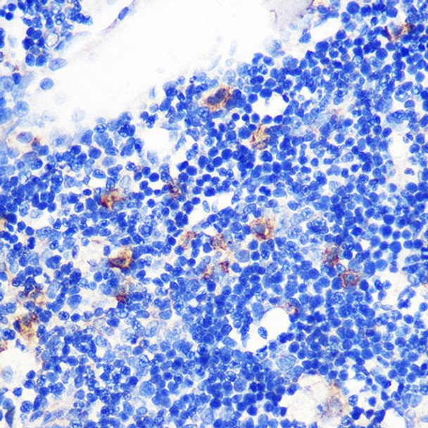 Anti-TGFB1 Antibody (CAB15103)