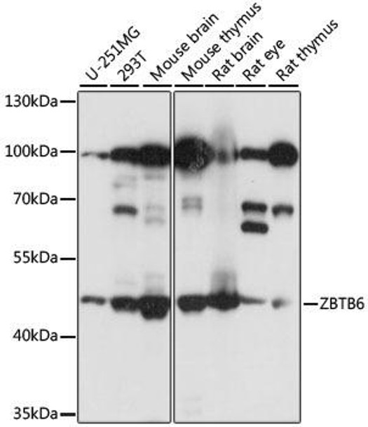 Anti-ZBTB6 Antibody (CAB15136)