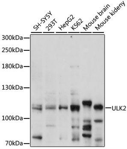 Anti-ULK2 Antibody (CAB15244)