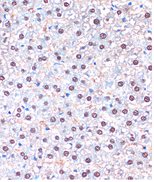 Anti-UBA5 Antibody (CAB15514)