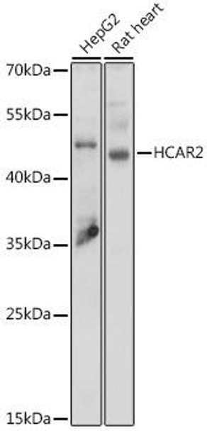 Anti-HCAR2 Antibody (CAB15611)