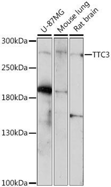 Anti-TTC3 Antibody (CAB15734)