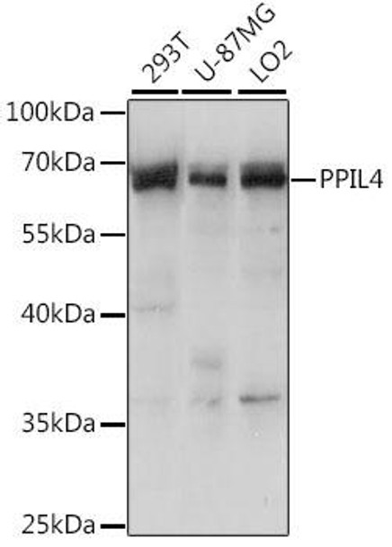 Anti-PPIL-4 Antibody (CAB15920)