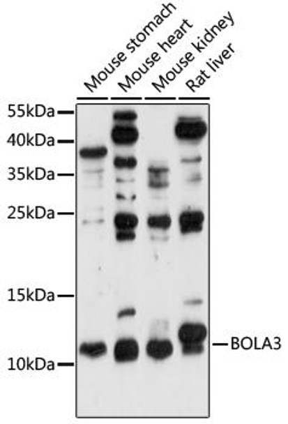 Anti-BOLA3 Antibody (CAB15985)