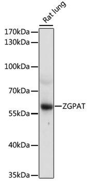Anti-ZGPAT Antibody (CAB16583)