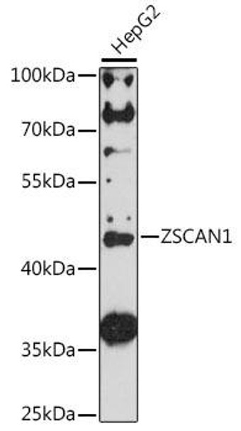 Anti-ZSCAN1 Antibody (CAB16639)