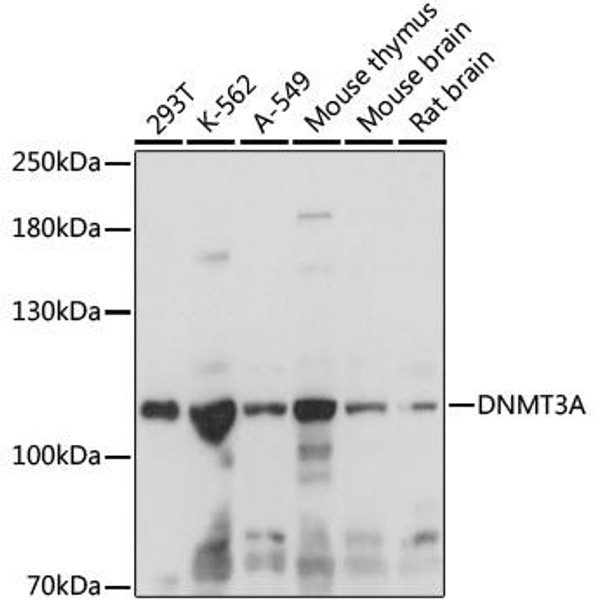 Anti-DNMT3A Antibody (CAB16834)