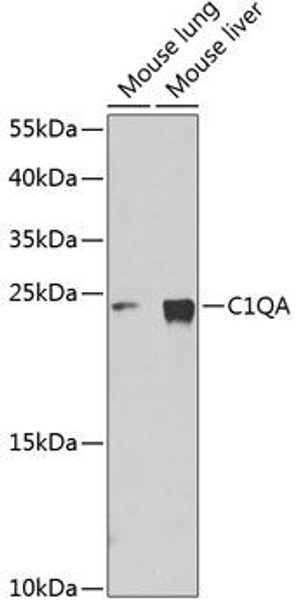 Anti-C1QA Antibody (CAB1821)