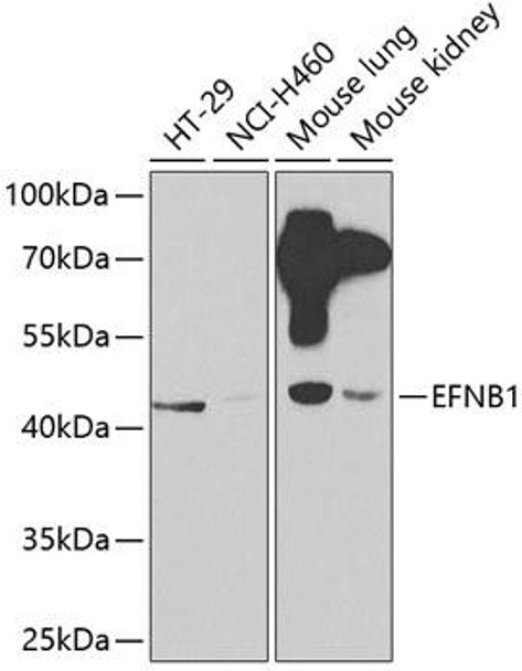 Anti-EFNB1 Antibody (CAB2518)