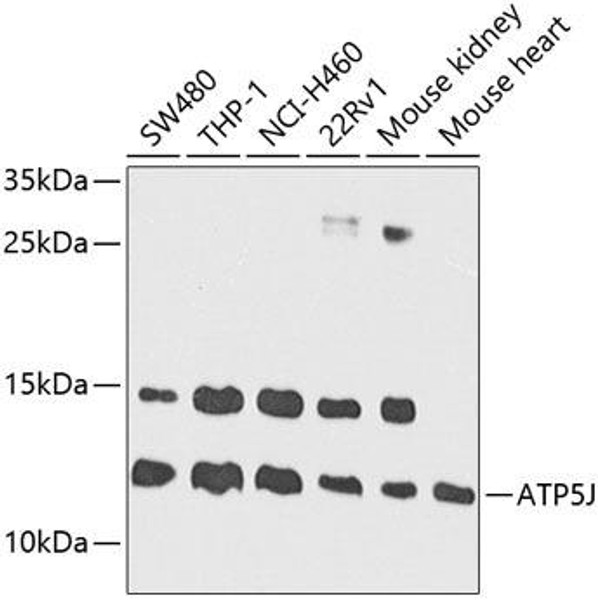 Anti-ATP5J Antibody (CAB3751)