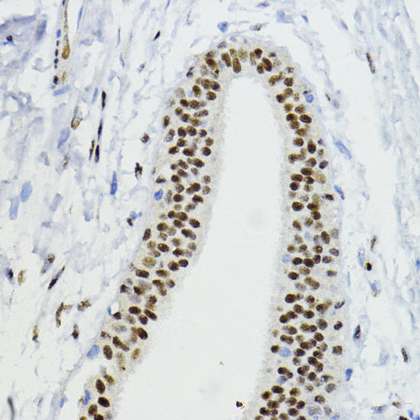 Anti-ZEB1 Antibody (CAB5600)