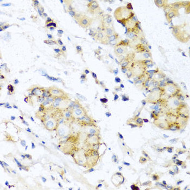 Anti-IFNL3 Antibody (CAB5648)