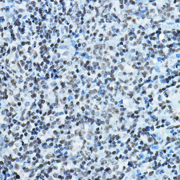 Anti-KAT7 Antibody (CAB5823)