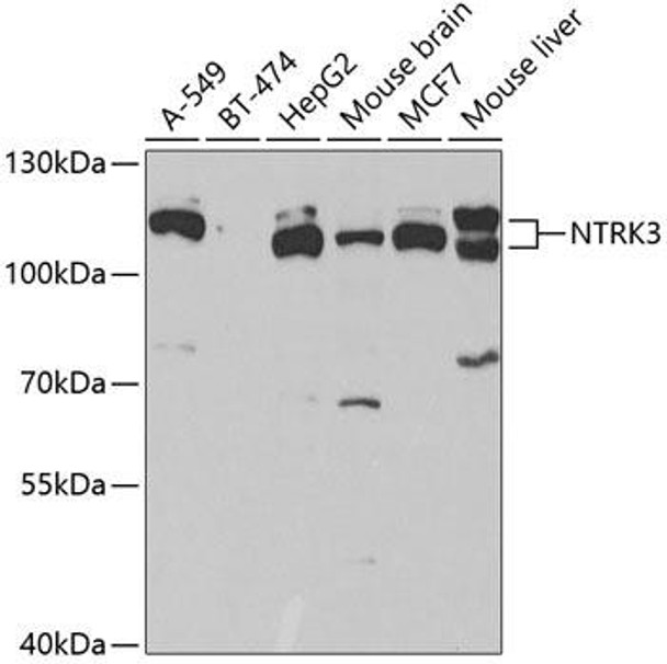 Anti-NTRK3 Antibody (CAB5842)