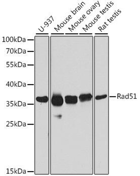 Anti-Rad51 Antibody (CAB6268)