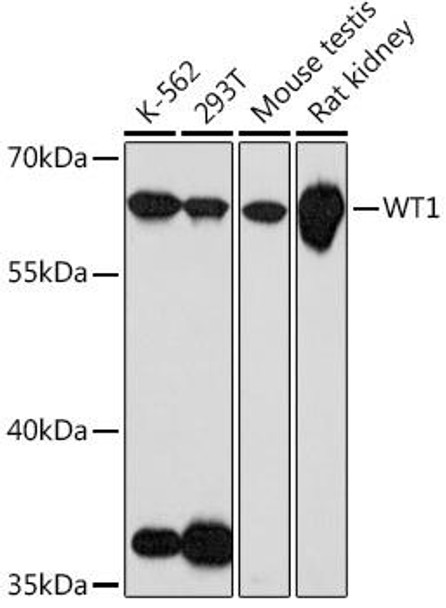 Anti-WT1 Antibody (CAB17006)