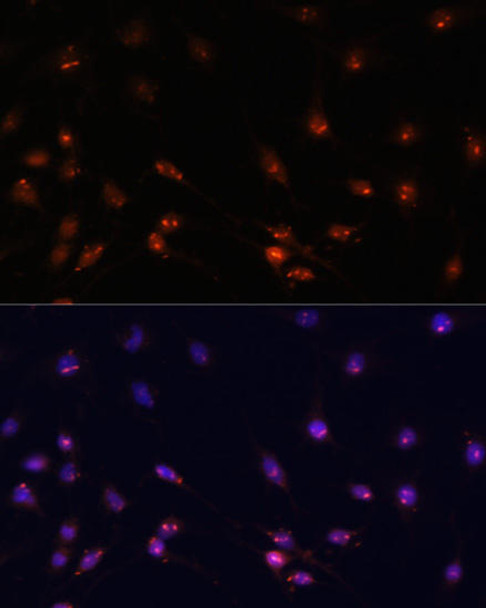 Anti-ATR Antibody (CAB17294)