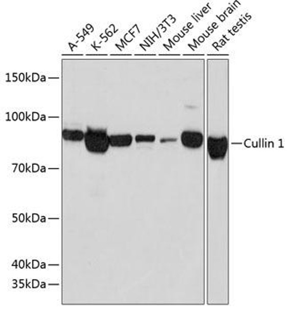 Anti-Cullin 1 Antibody (CAB19034)