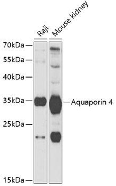 Anti-Aquaporin 4 Antibody (CAB5665)