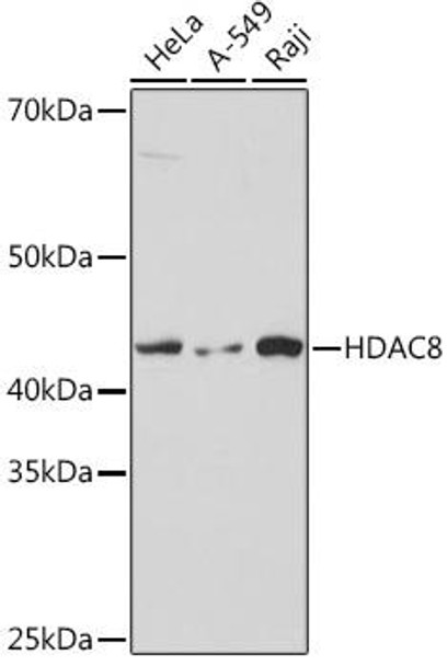 Anti-HDAC8 Antibody (CAB8865)