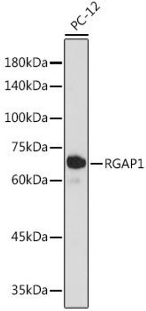 Anti-RGAP1 Antibody (CAB19236)