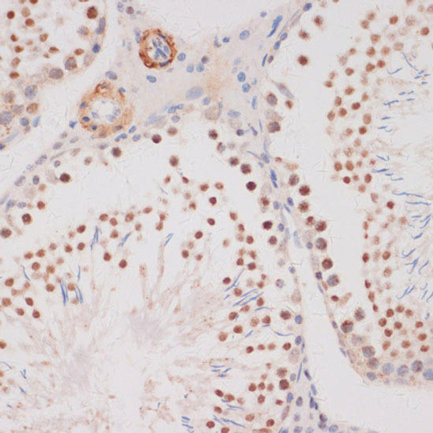 Anti-DDIT3 / CHOP Antibody (CAB0221)