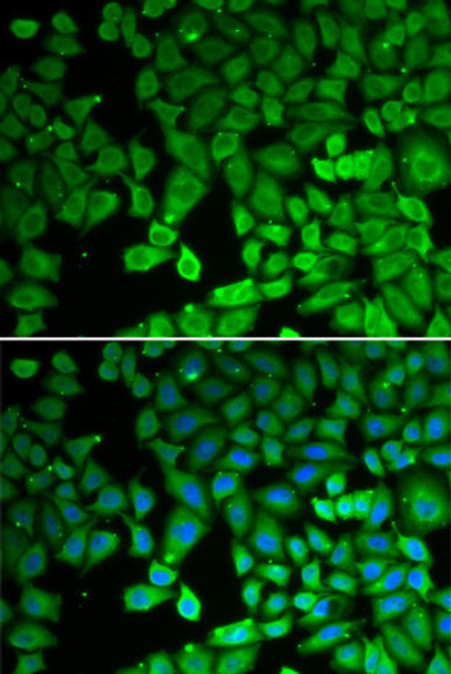 Anti-NUR77 Antibody (CAB0843)